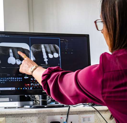 Dentist reviewing dental scans